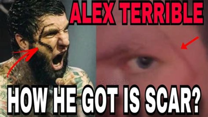 "Alex Terrible Face Scar" Unraveled